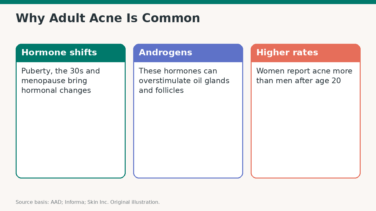 Adult Acne in Women: Causes, Triggers and Treatment